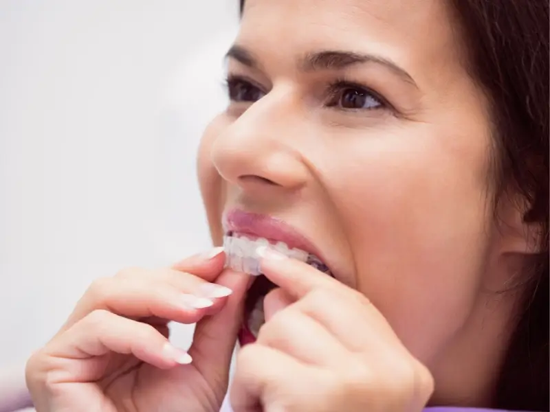 £12,000 Compensation for Client for Negligent Invisalign Dental Treatment